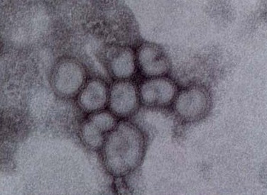 �C���t���G���U